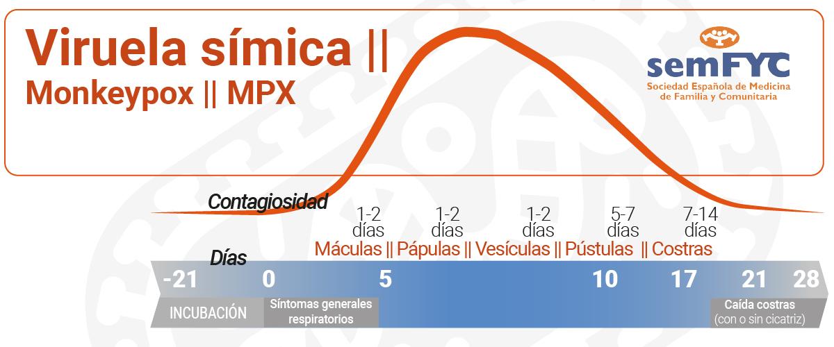 Infografía: viruela símica